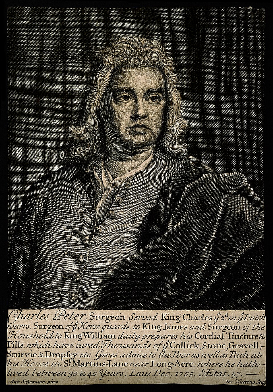 Illustration: Building Delivery Consistency for Line Control